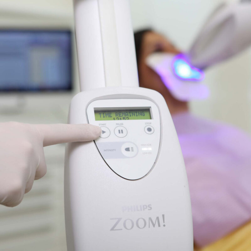 Zahnaerzte_am_Augustaplatz_Bleaaching_Zahnaufhellung_Kachel Zahnaerzte_am_Augustaplatz_Bleaaching_Zahnaufhellung_Kachel