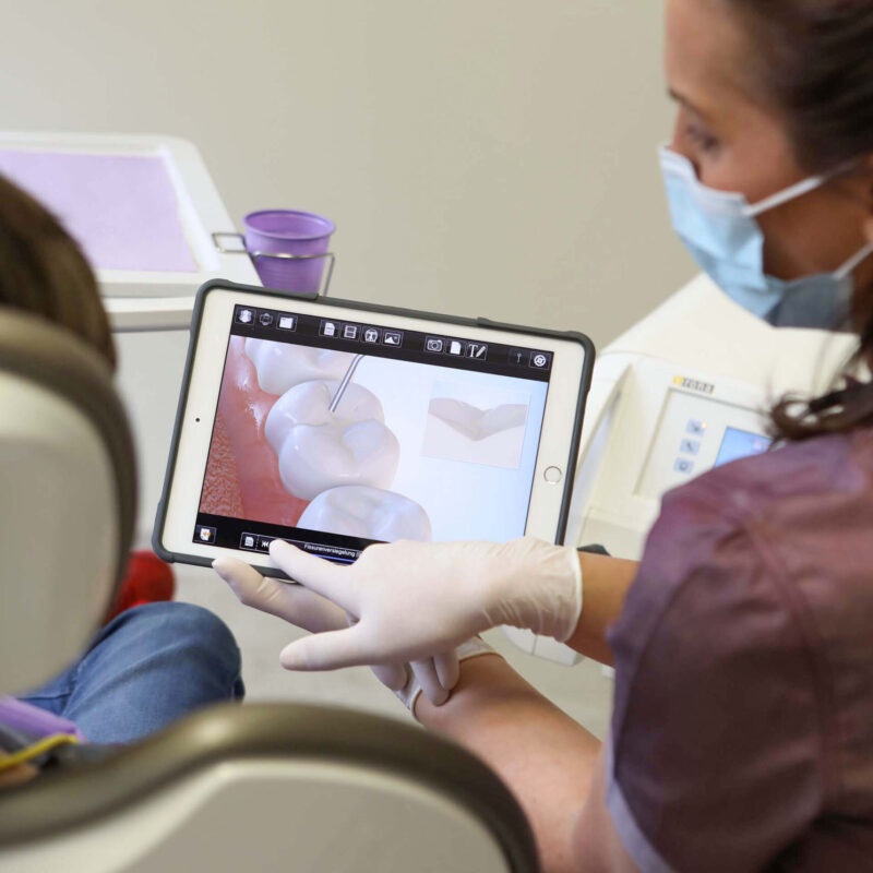 Zahnaerzte_am_Augustaplatz_Fissurenversiegelung_Kachel Zahnaerzte_am_Augustaplatz_Fissurenversiegelung_Kachel