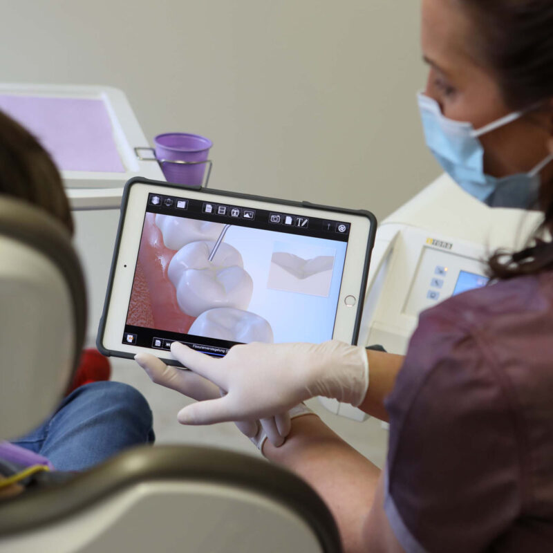 Zahnaerzte_am_Augustaplatz_Fissurenversiegelung_Kachel Zahnaerzte_am_Augustaplatz_Fissurenversiegelung_Kachel