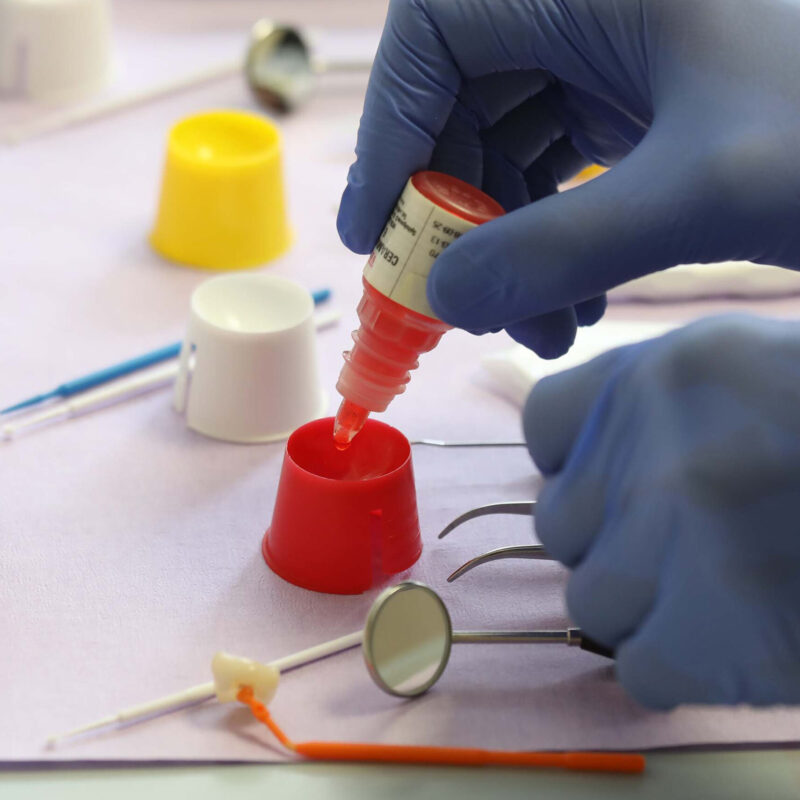 Zahnaerzte_am_Augustaplatz_Keramikinlays_Kachel Zahnaerzte_am_Augustaplatz_Keramikinlays_Kachel