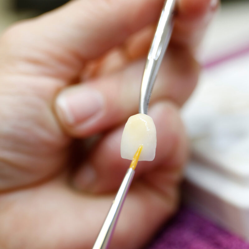 Zahnaerzte_am_Augustaplatz_Veeners_Kachel Zahnaerzte_am_Augustaplatz_Veeners_Kachel