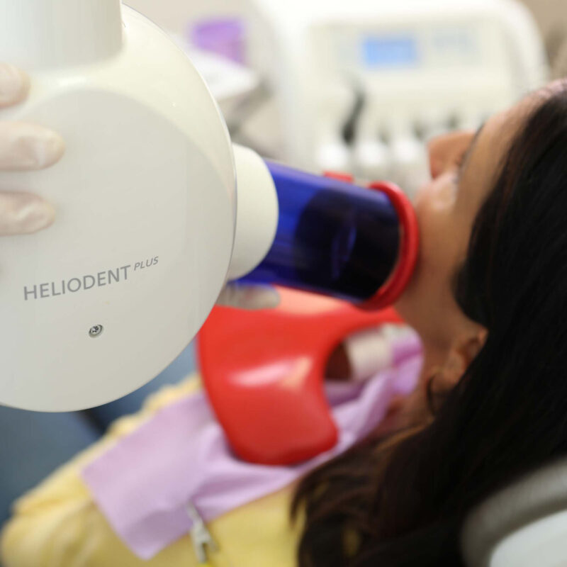 Zahnaerzte_am_Augustaplatz_Wurzelbehandlung_Endodontie_Kachel Zahnaerzte_am_Augustaplatz_Wurzelbehandlung_Endodontie_Kachel