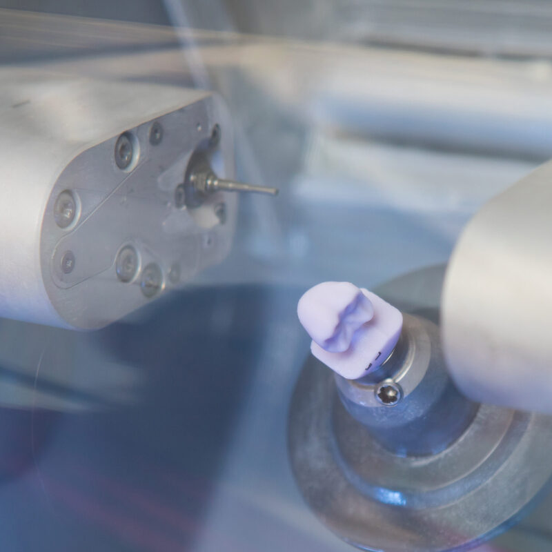 Zahnaerzte_am_Augustaplatz_CEREC_Kachel Zahnaerzte_am_Augustaplatz_CEREC_Kachel